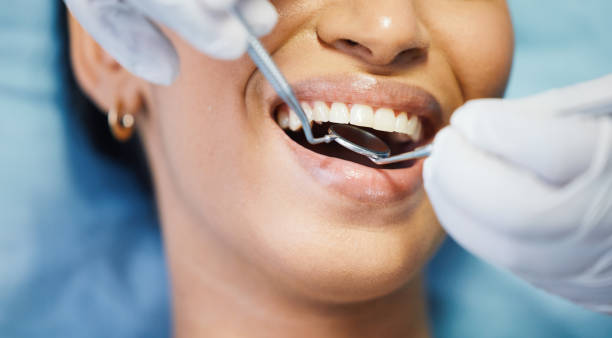 Best Emergency Dental Care for Broken or Chipped Teeth in Muenster, TX