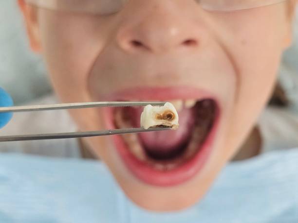 Best Weekend Emergency Dentist in Muenster, TX